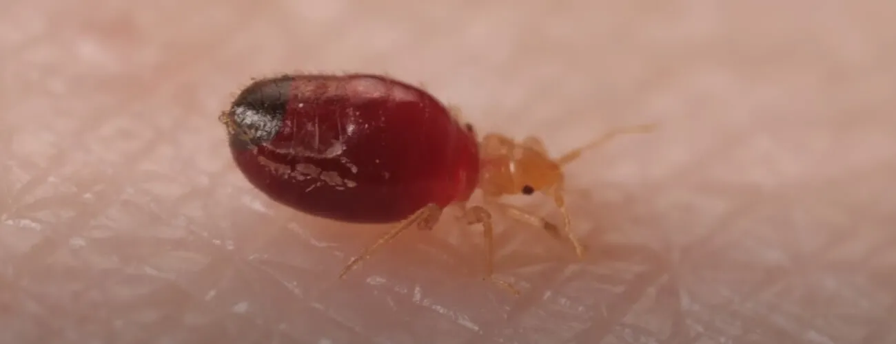 Бельевой клоп кусает человека Постельный клоп кусает человека