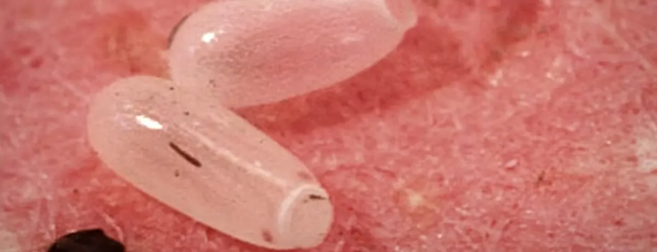 Яйца постельных клопов